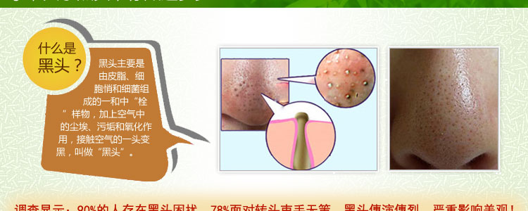 綠島緣 竹炭手工皂 去黑頭潔面皂 控油清爽洗臉皂 美白收縮毛孔