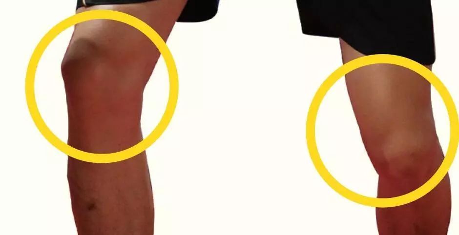 打乒乓球如何保护自己的膝盖？